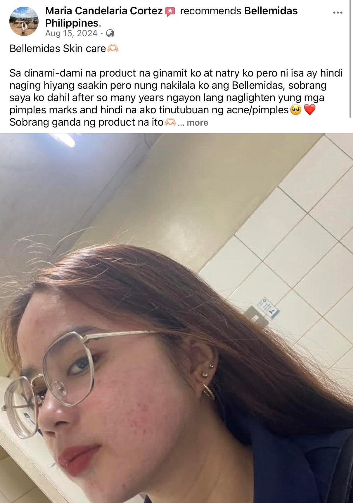 Bellemidas Cloud White Glow Set – Fade Dark Spots. Reveal Radiant Skin                                            ✔ Targets post-acne marks  
✔ Brightens uneven skin tone  
✔ Day & Night complete routine ⭐⭐⭐⭐⭐ 10,000+ Verified Customers