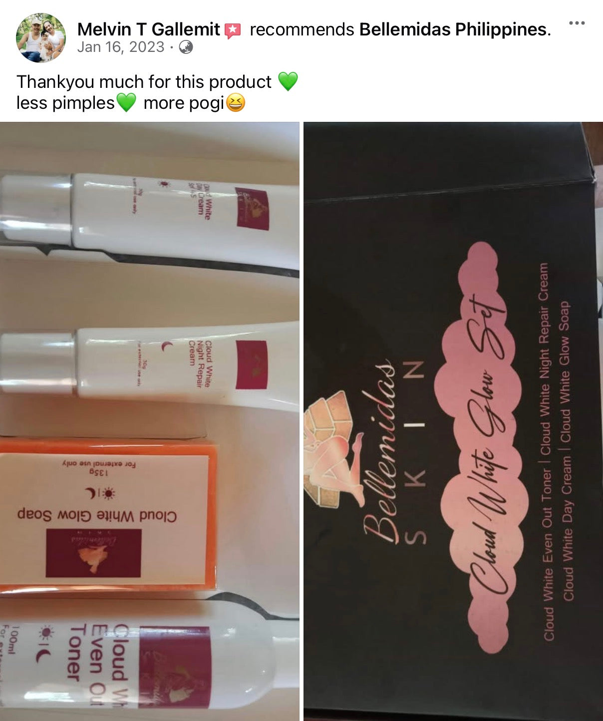 Bellemidas Cloud White Glow Set – Fade Dark Spots. Reveal Radiant Skin                                            ✔ Targets post-acne marks  
✔ Brightens uneven skin tone  
✔ Day & Night complete routine ⭐⭐⭐⭐⭐ 10,000+ Verified Customers