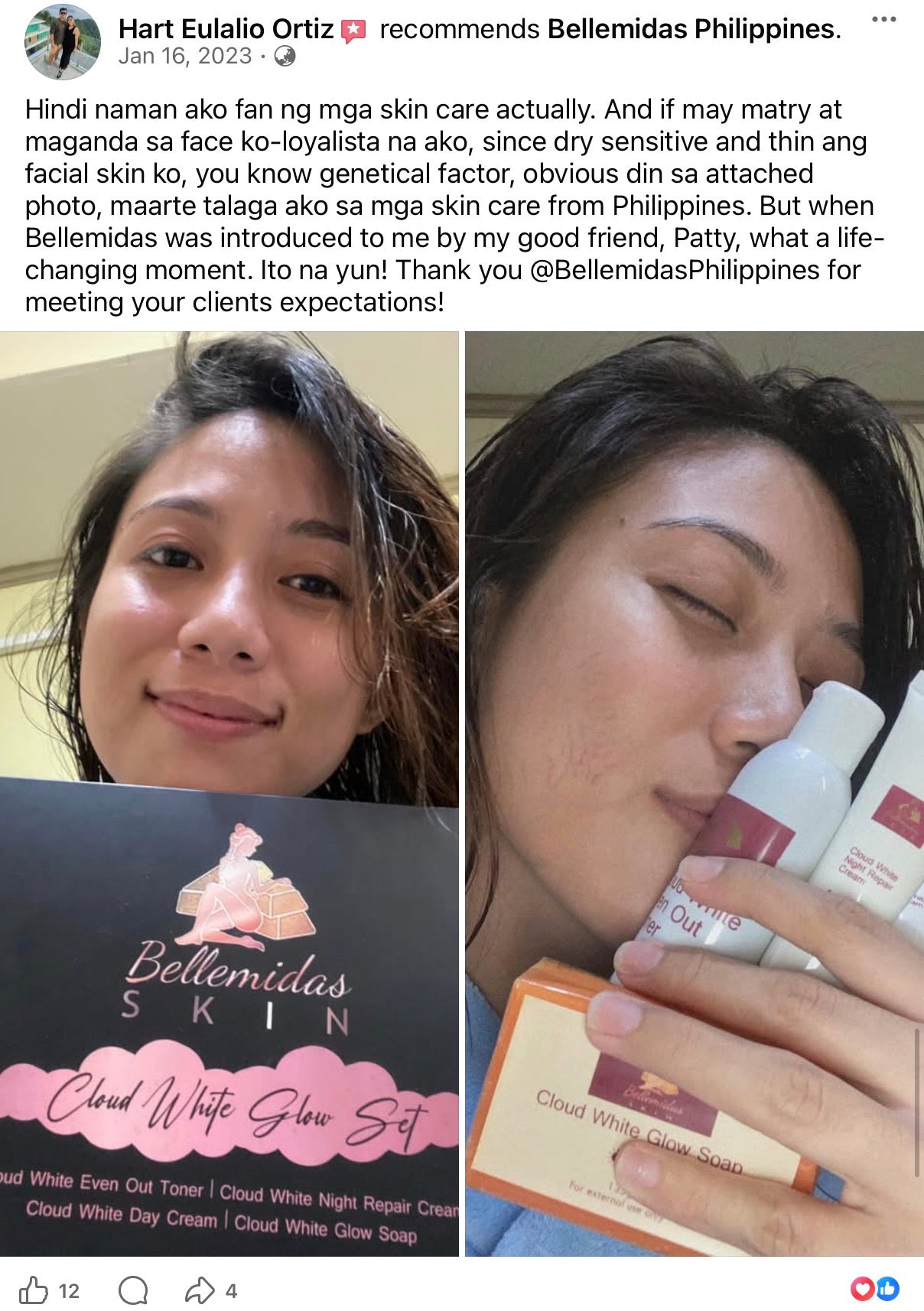 Bellemidas Cloud White Glow Set – Fade Dark Spots. Reveal Radiant Skin                                            ✔ Targets post-acne marks  
✔ Brightens uneven skin tone  
✔ Day & Night complete routine ⭐⭐⭐⭐⭐ 10,000+ Verified Customers