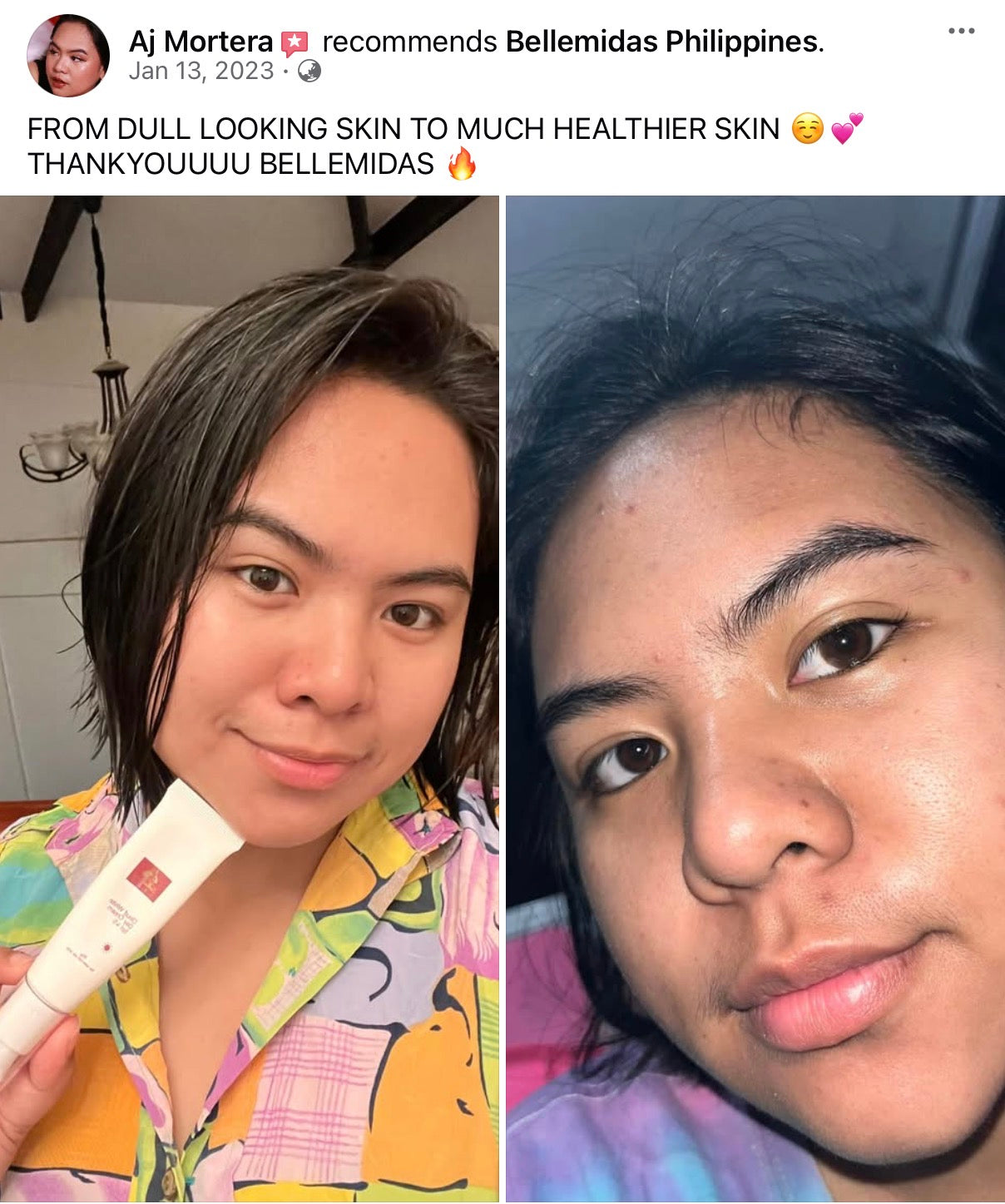 Bellemidas Cloud White Glow Set – Fade Dark Spots. Reveal Radiant Skin                                            ✔ Targets post-acne marks  
✔ Brightens uneven skin tone  
✔ Day & Night complete routine ⭐⭐⭐⭐⭐ 10,000+ Verified Customers