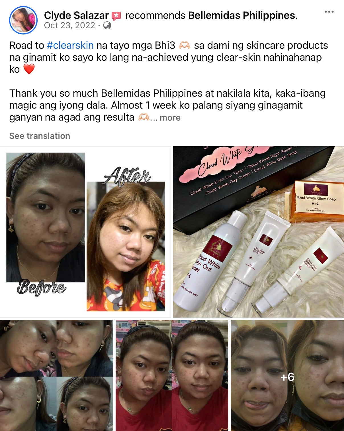 Bellemidas Cloud White Glow Set – Fade Dark Spots. Reveal Radiant Skin                                            ✔ Targets post-acne marks  
✔ Brightens uneven skin tone  
✔ Day & Night complete routine ⭐⭐⭐⭐⭐ 10,000+ Verified Customers