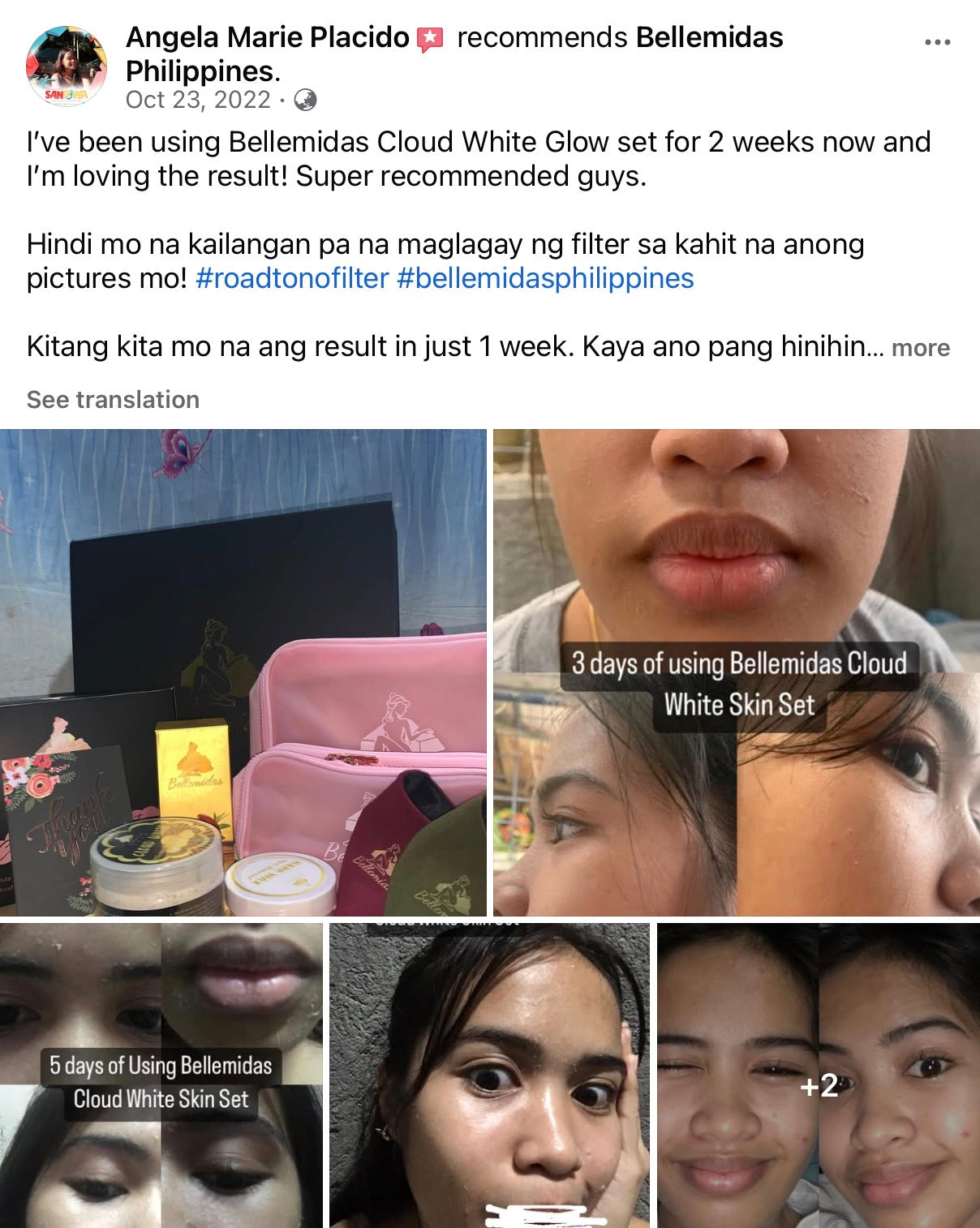 Bellemidas Cloud White Glow Set – Fade Dark Spots. Reveal Radiant Skin                                            ✔ Targets post-acne marks  
✔ Brightens uneven skin tone  
✔ Day & Night complete routine ⭐⭐⭐⭐⭐ 10,000+ Verified Customers