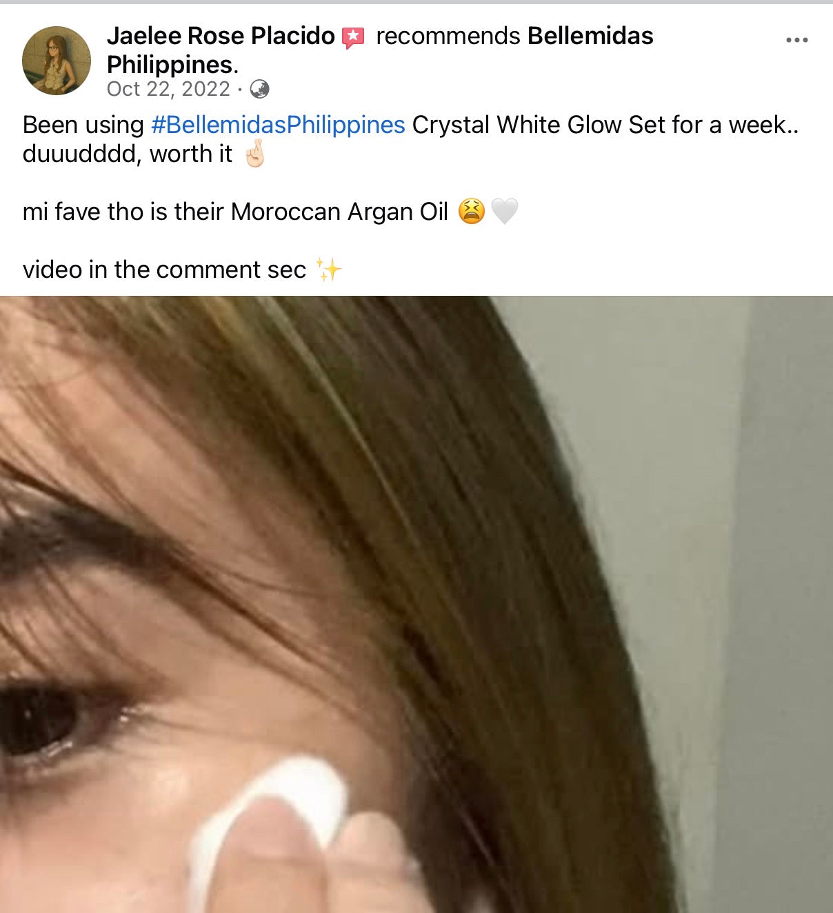 Bellemidas Cloud White Glow Set – Fade Dark Spots. Reveal Radiant Skin                                                               ✔ Targets post-acne marks  
✔ Brightens uneven skin tone  
✔ Day & Night complete routine ⭐⭐⭐⭐⭐ 10,000+ Verified Customers