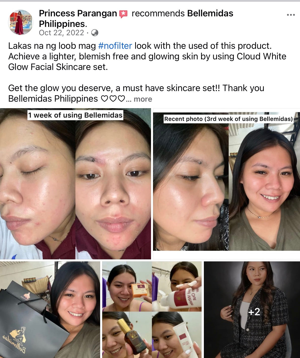 Bellemidas Cloud White Glow Set – Fade Dark Spots. Reveal Radiant Skin                                            ✔ Targets post-acne marks  
✔ Brightens uneven skin tone  
✔ Day & Night complete routine ⭐⭐⭐⭐⭐ 10,000+ Verified Customers