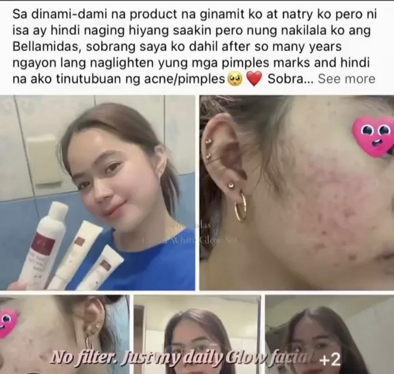 Bellemidas Cloud White Glow Set – Fade Dark Spots. Reveal Radiant Skin                                            ✔ Targets post-acne marks  
✔ Brightens uneven skin tone  
✔ Day & Night complete routine ⭐⭐⭐⭐⭐ 10,000+ Verified Customers